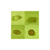 Stained PVA Smear